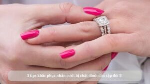 nhẫn cưới bị chật